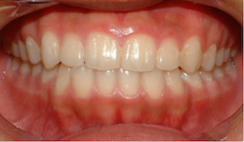 Pre tretmana - stomatološki slučaj 1